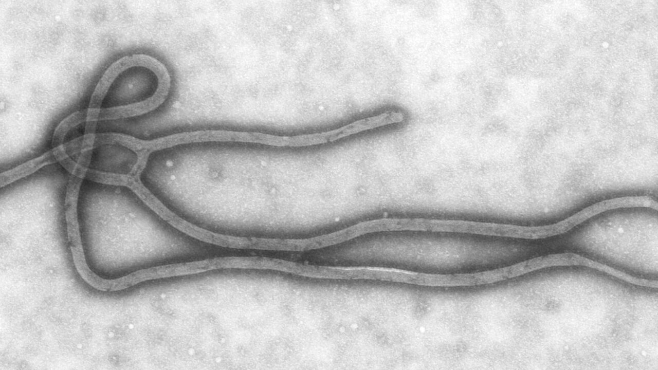 Electron micrograph of an Ebola virus particle (CDC)
