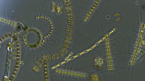 A microscopy image of a mixed phytoplankton community from the ocean