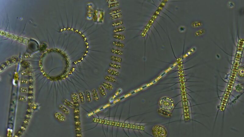 A microscopy image of a mixed phytoplankton community from the ocean
