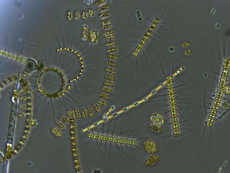 A microscopy image of a mixed phytoplankton community from the ocean